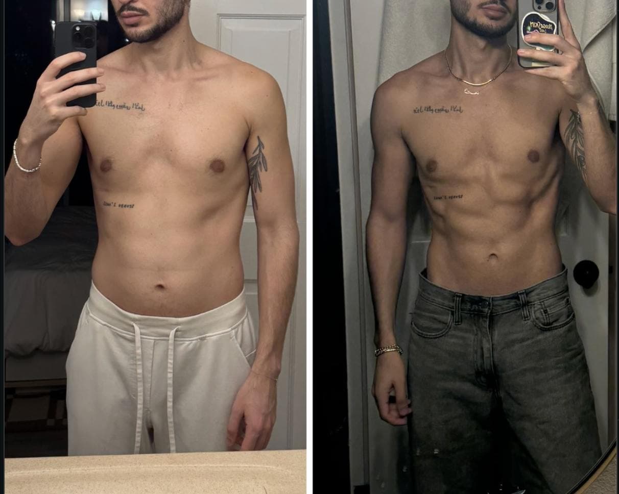 Retatrutide Before and After: Real Results from the Community (2026)